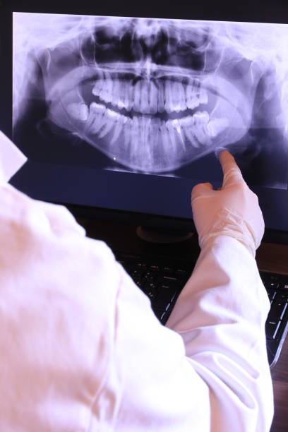 Best Root Canal Emergency Dentist  in Marion, NC