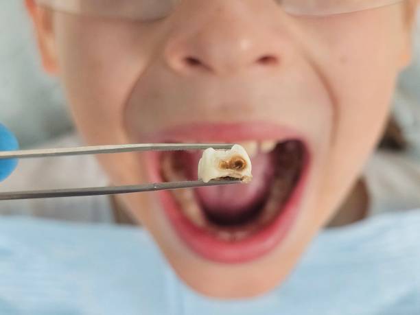 Emergency Dentist Open Today in NC