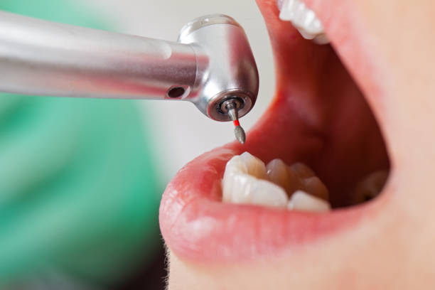 Best Cracked Tooth Emergency Dentist  in Marion, NC